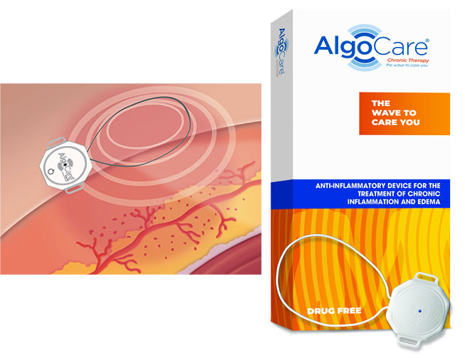 WHX Dubai 2026 | TSS MEDICAL SRL |